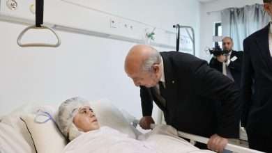 تبون مستشفى الحروق